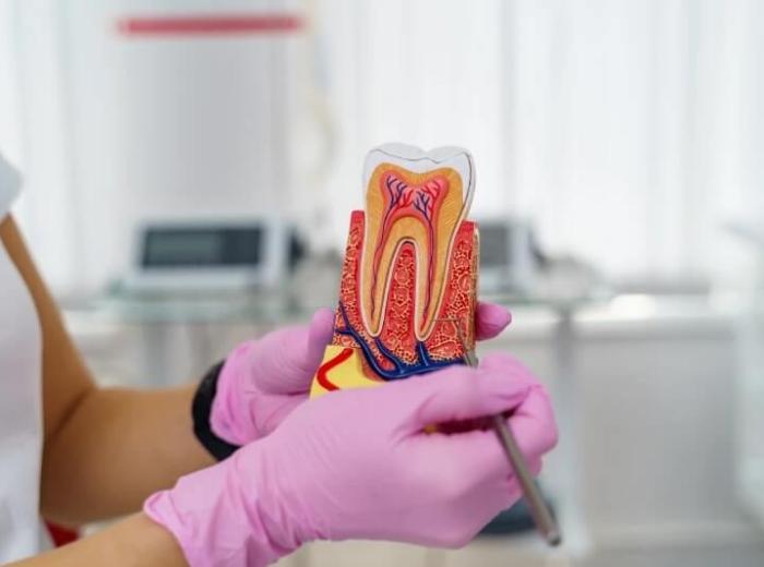 How to Know If You Need a Root Canal